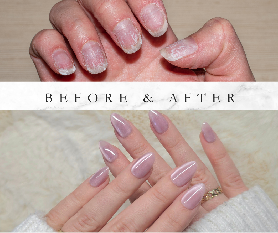 Rimeddi per unghie rovinate dal gel, press-on nails